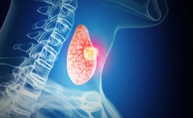 What Are Thyroid Nodules?