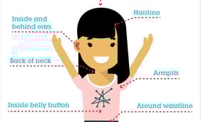 Lyme Disease: Important Facts to Know