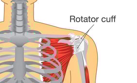 What Is My Rotator Cuff, and Why Does It Hurt?
