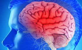 Understanding Dystonia: A Comprehensive Guide