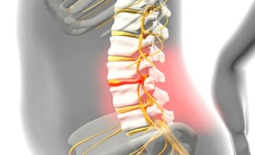 Herniated Disk: Symptoms and Diagnosis