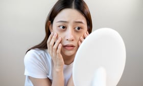 不用醫美！輕鬆消除黑眼圈的天然秘方大公開