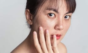 黑斑消不掉？醫師公開3大溫和祛斑秘訣，安全又有效！